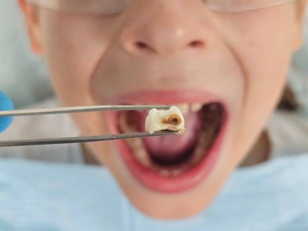 Best Emergency Cosmetic Dentistry in Oak Ridge, FL